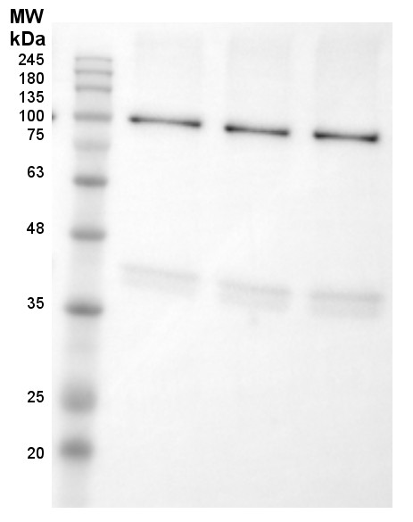 Western blot using anti-LOX antibodies on potato tuber flesh